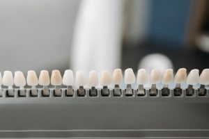 Porcelain Veneers Perfect Smile