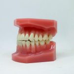 Teeth Grinding Night Guard Round Rock