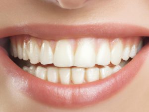 Teeth Whitening Bright Smile Dental