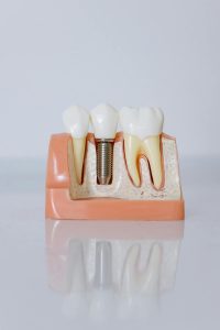Dentures and removable dental prosthetics at Red Bud Dental in Round Rock TX