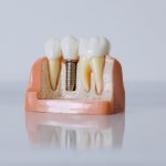 Glp1 Dry Mouth Round Rock